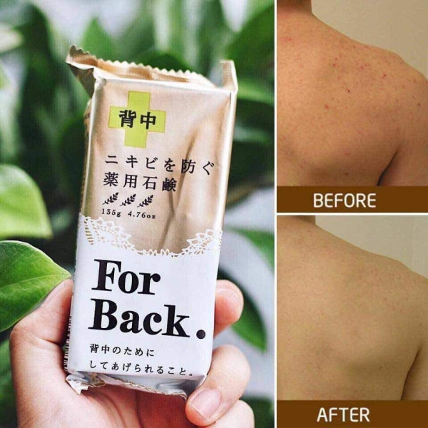 Xà Phòng Tắm Sạch Mụn Lưng _Nhật Bản (Bánh)