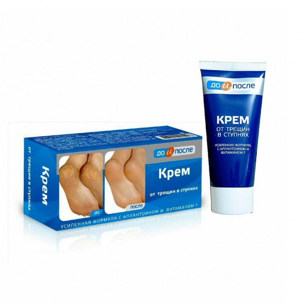 Kem Bôi Trị Nứt Gót Chân Nga Kpem (T50Ml)