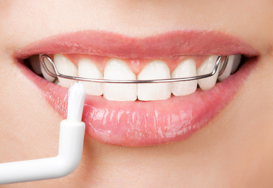 Dental Orthodontics